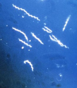 Borrelia_burgdorferi-cropped