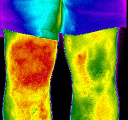 BOS_IR_JF_male knees_1