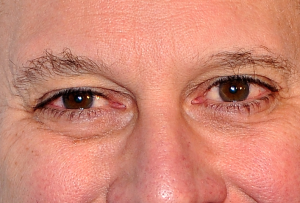 Eric Schneiderman's eyes. (Cropped. Photo base: Getty/Stephen Lovekin)