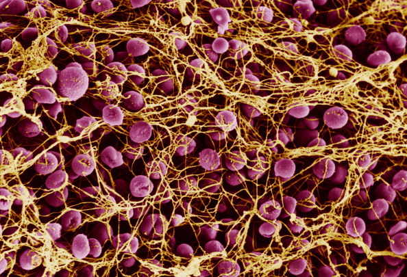 Blood Coagulation (Photo By BSIP/UIG Via Getty Images)