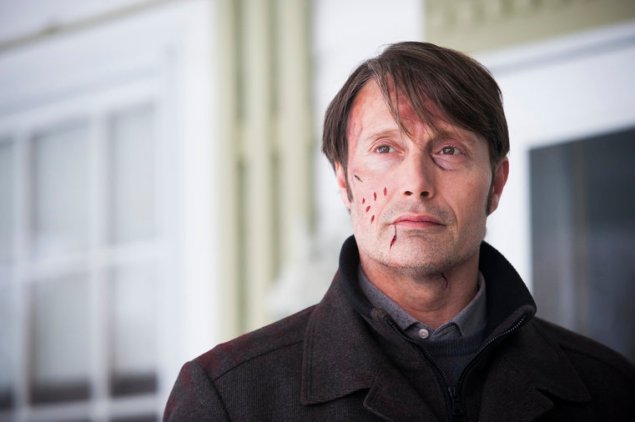 HANNIBAL -- "Digestivo" Episode 307 -- Pictured: Mads Mikkelsen as Hannibal Lecter -- (Photo by: Brooke Palmer/NBC)