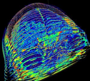 CT Scan of the brain (Wikipedia).