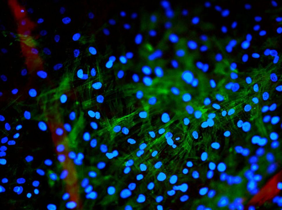 Human mesenchymal stem cells attached to fibrin (5 mg/mL) within a porous network of ferritic stainless steel intended for implant coatings.
