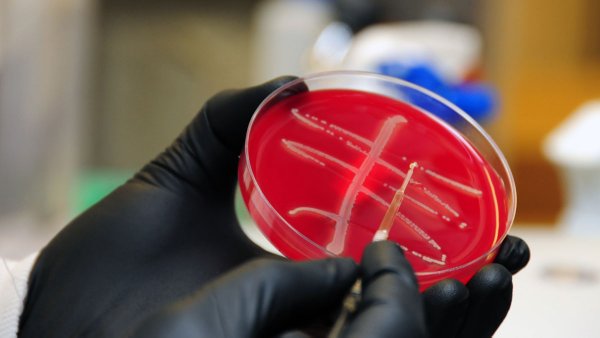 The discovery of an antibiotic resistant "superbug" has raised alarm bells in the medical community,