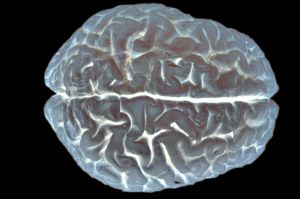 The cerebral cortex.