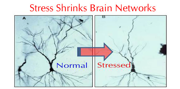 Stress shrinks brain networks