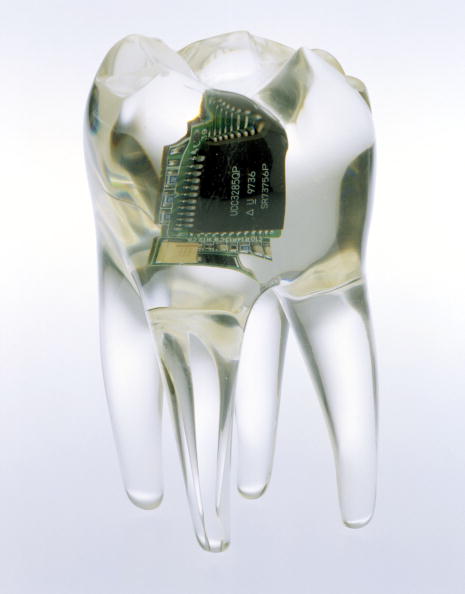 UNITED KINGDOM - JULY 05: Designed by James Auger, the audio tooth implant is a new concept in communications. 'It allows useful information to be sent to you in secret wherever you are and whenever you need it. A surgeon implants a device into a tooth, the data is received from a mobile phone, radio or computer vibrations which resonates through your jawbone to your inner ear. Only you can hear the information.' Currently, the implant only exists in concept form. (Photo by SSPL/Getty Images)