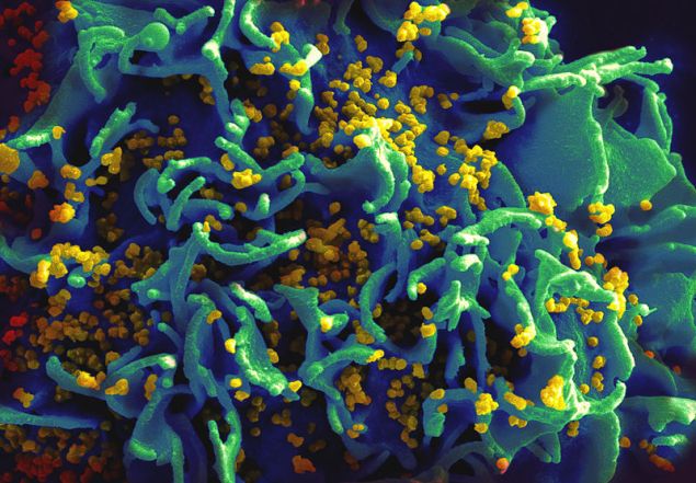 the HIV H9 T-cell.