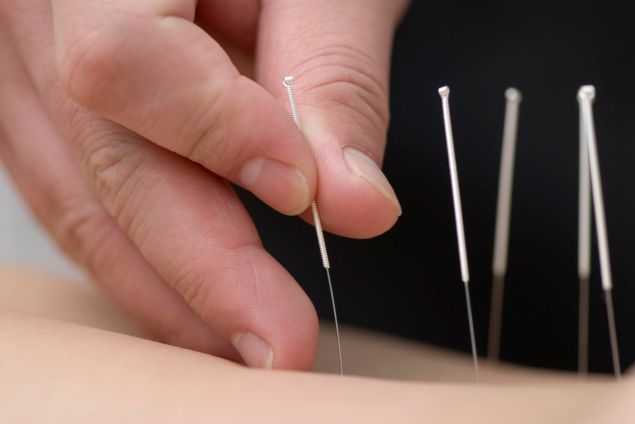 Is acupuncture real medicine? Wikipedia doesn't think so.