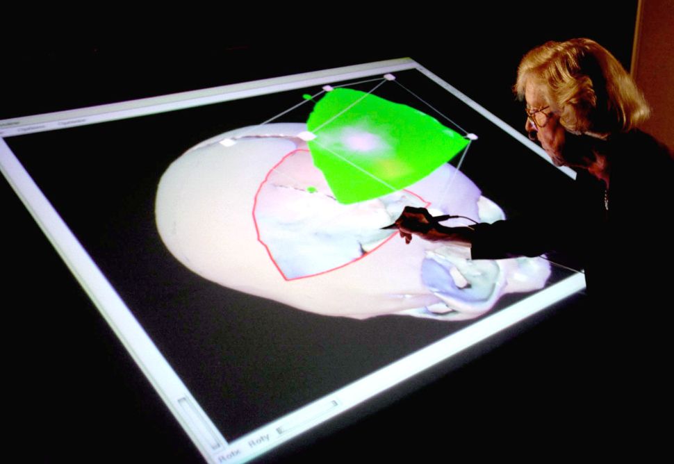 A physician wears 3-D glasses to look at a computerized image of a patient's head. The future of medicine is here.
