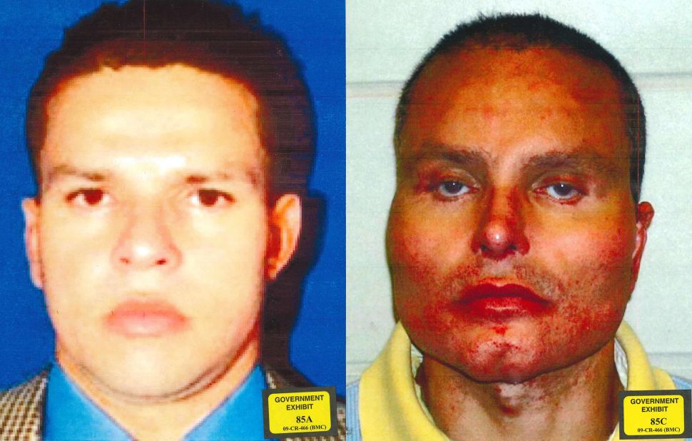Colombian drug lord Juan Carlos Ramírez Abadía, aka, Chupeta (lollipop), before and after facial reconstruction surgery meant to hide his identity.