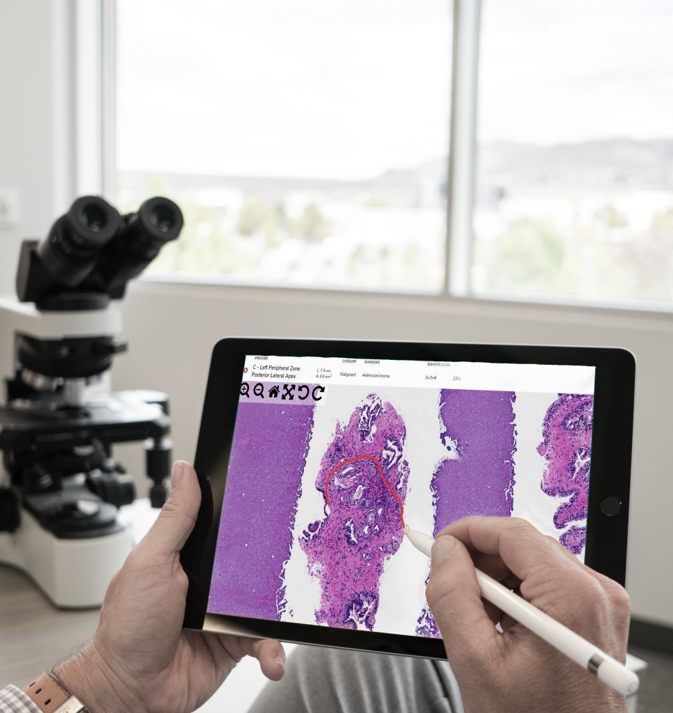 Lumea is a game changer for digital pathology.