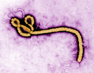 Ebola virus. (Center for Disease Control)